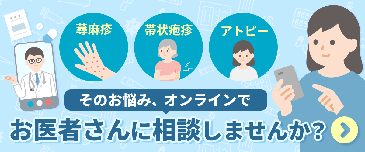 蕁麻疹・帯状疱疹・アトピー そのお悩み、オンラインでお医者さんに相談しませんか?