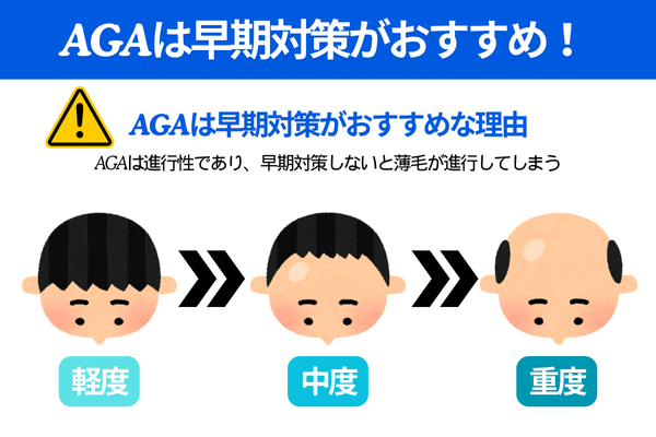 AGAは早期対策がおすすめ